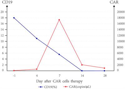 Benefits of Chimeric Antigen Receptor T-Cell Therapy for B-Cell Lymphoma